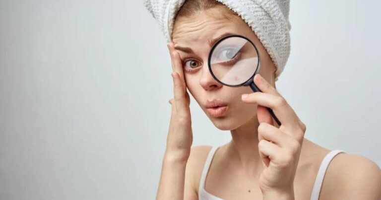 Woman with rash using magnifying glass to look at skincare ingredients